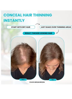 SureThik SURETHIK Hair Fibers for Thinning Hair, Building Hair Fibers to conceal thinning hair, Instantly Fuller Looking Hair for Men & Women, Dark Brown, 15g  - Image 2