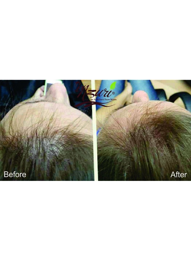 Nzuri Elixir Hair Skin And Nail With Vitamin D 32 Oz + Nzuri Hair Follicle Food 61 Ancient Miracle Hair Growth Oil 4Oz Vitamins To Make Hair Grow Long Intense Grow Long Hair Supplements Combo Pack - Image 3