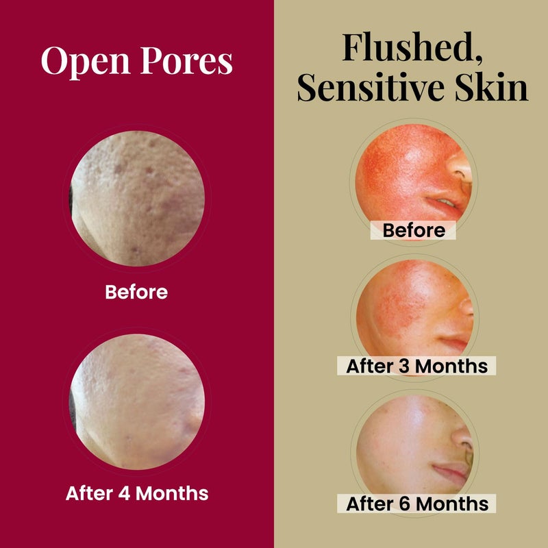 LABO Nutrition Le Revital Concentrated Nano Placenta Extract Serum Essence from Japan â€“ Hydrating, Glowy, Moisturizing for Face Wrinkles, Dull Skin, Tone, Soothing & Skin Barrier Strength | 4 Vials - Image 4