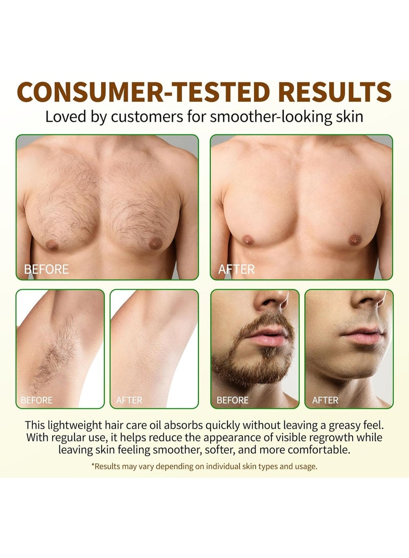 ATRJSZ 60ml Cyperus Rotundus Oil for Hair Removal，Inhibits Excessive Hair Growth, Reduces Excess Hair On the Body, Moisturizes and Soothes the Skin, Shrinks Pores, Suitable for All Skin Types - Image 3