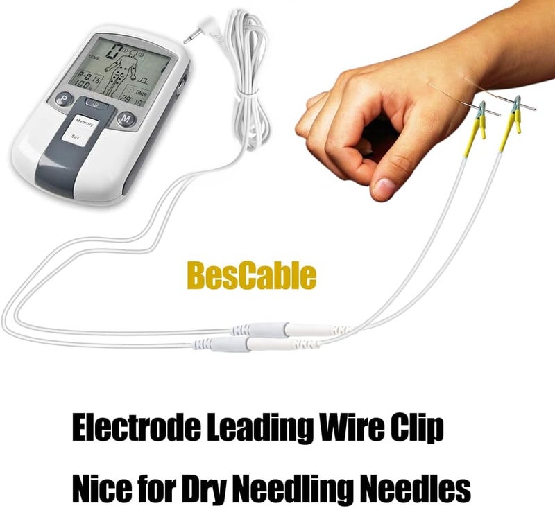 BesCable Electrode Wire for Dry Needling Needles - 20pcs TENS Leading Wires with Alligator Clips for TENS Unit Physiotherapy Machine - 2.0mm Pin Female to Alligator Clip Cable - Image 2