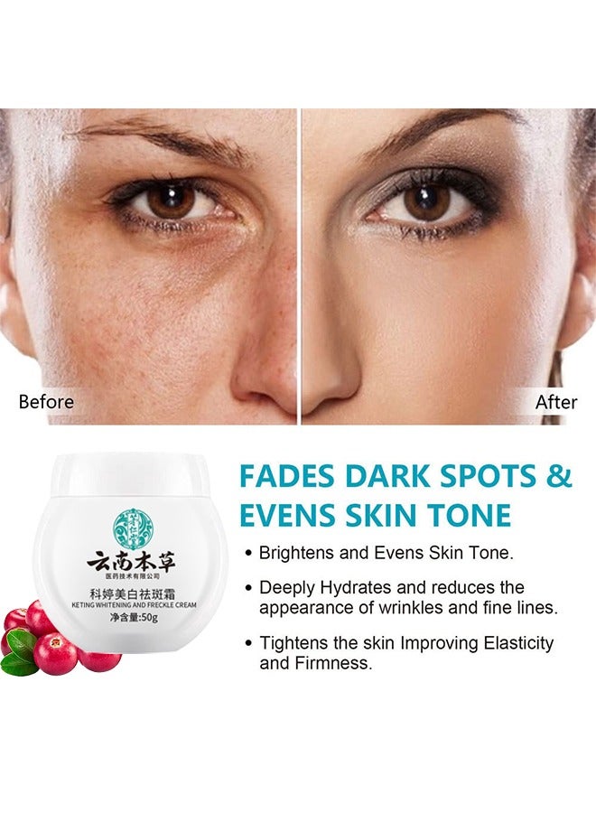 Beauenty White Spot Cream, Whitening Freckle Cream Remove Melasma Cream, Dark Spot Remover For Face Hyperpigmentation Treatment, Dark Spot Corrector For Face, Smooth Skin Moisturizer Cream 50G - Image 2