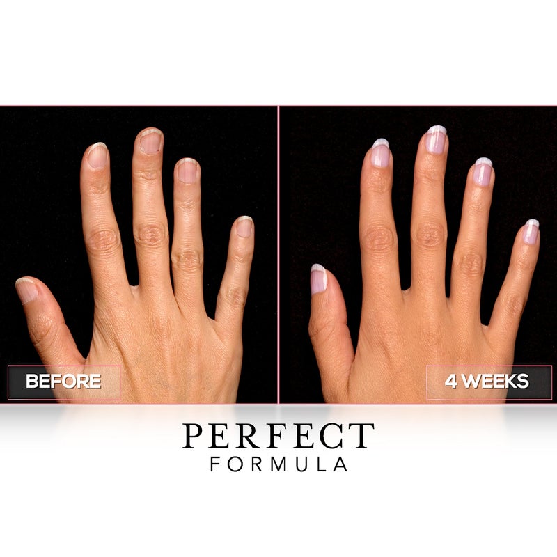 Perfect Formula Gel Coat Manicure Set - Nail Strengthener, Keratin Nail Treatment, Pink, Powder Pink, Taupe and Clear - Nail Strengthener for Damaged Nails - Made In The USA, 0.17 Fl Oz (4 Pieces) - Image 4