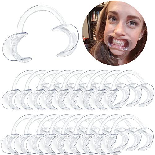 THINKPRICE 30-Pack Dental Cheek Retractor, Professional Autoclavable Mouth Opener Retractors, 100% BPA-Free, for Dentist, Teeth Whitening, Party, Mouthguard Challenge Game - Size M, Clear - Image 1