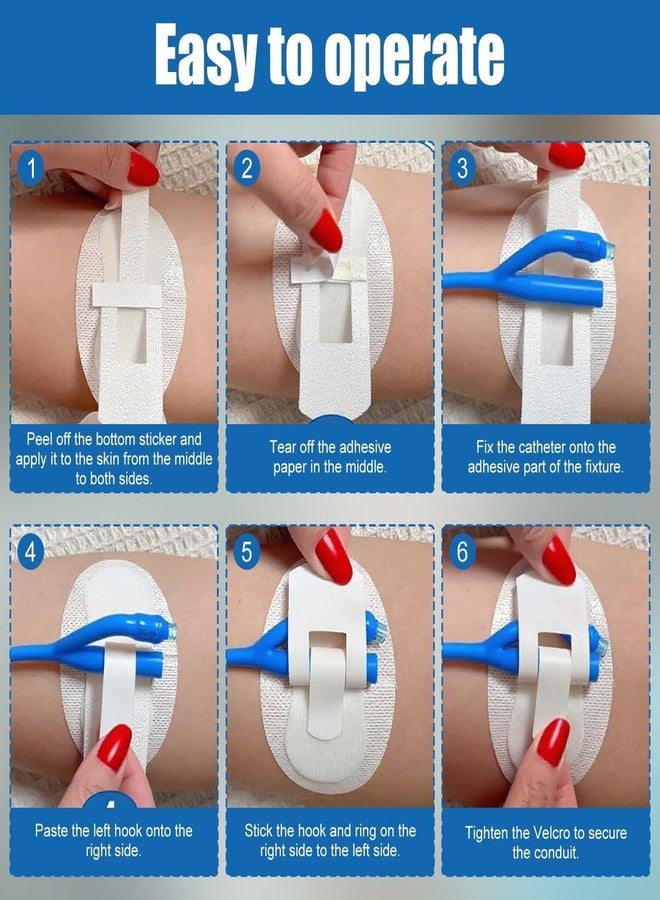 Foyods Catheter Stabilization Devices - 8 PCS Self-High Adhesive Catheter Holder, Catheters Urinary Leg Bag Legband Holder, Catheters Supplies for Single & Double Tubes and Feeding Tubes - Image 5