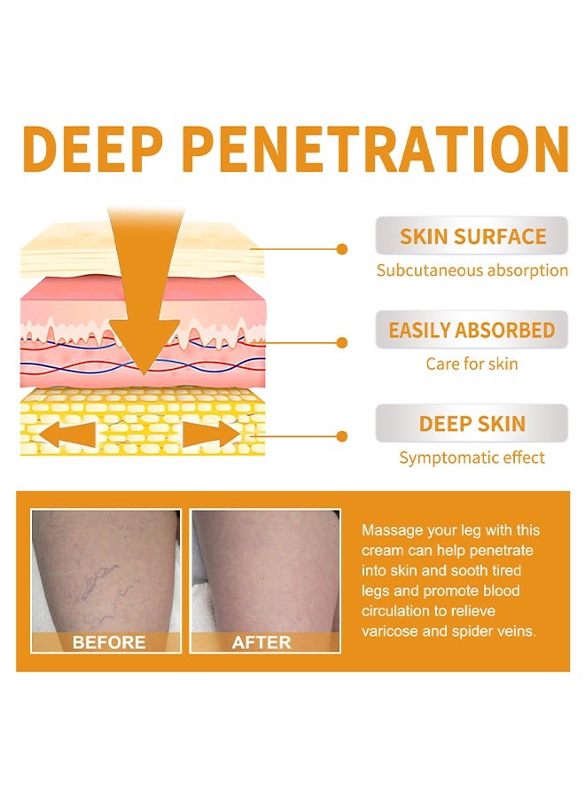 إيلهو فيتامين ك - كريم الدوالي ، كريم مهدئ للساق ، كريم علاج الدوالي والأوردة العنكبوتية ، تحسين الدورة الدموية ، تخفيف آلام التورم بسرعة 60 جرام - Image 4