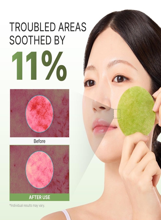 P.CALM Azelaic Acid Matcha 1000 Gauze Gel Toner Pad | Azelaic Acid & Matcha for Daily Resurfacing, Skin Soothing & Hydration, Gentle Exfoliating Toner Pads | Korean Skincare, 110g / 3.88 oz, 60 Pads - Image 3