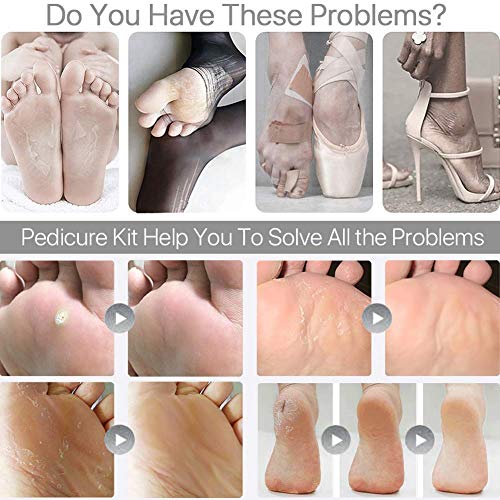 Vitalogy - Pedicure Tools for Feet - 8 in 1 Pedicure Kit | Foot Scrubber for Dead Skin, Callus Remover, Foot Scraper, Foot File, Pitchfork, Filer for Nail Repair - 1 Set - Image 5