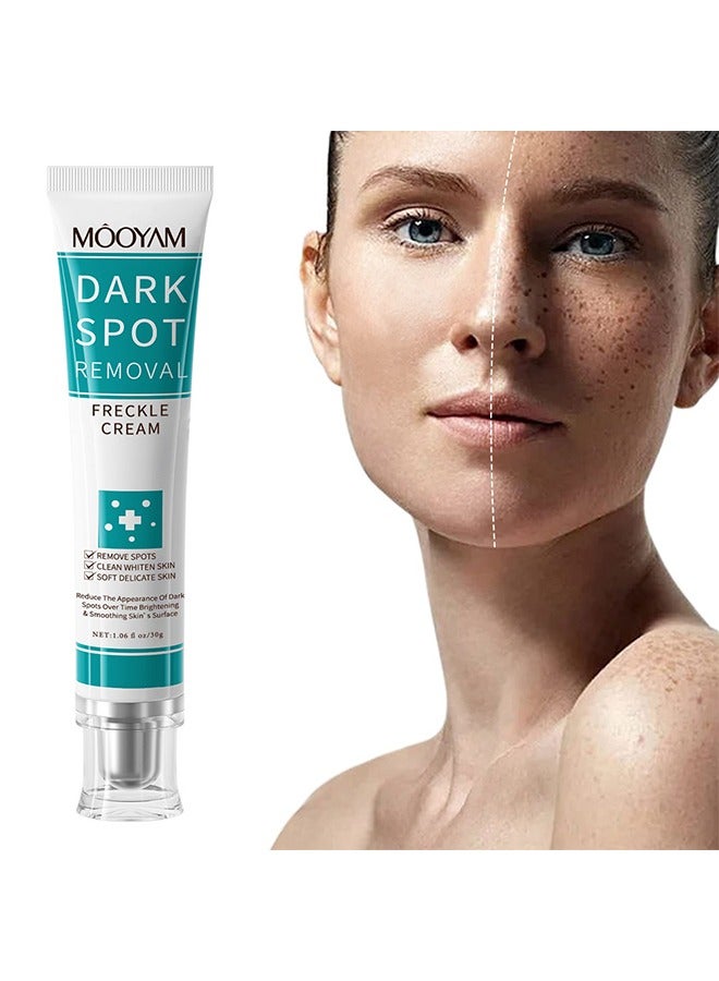 MOOYAM Dark Spot Removal Freckle Cream, Fast-Acting Dark Spot Corrector Remover For Face And Body Hyperpigmentation, Fades Melasma, Freckle, Sun Spots, Evens Skin Tone, Age Spot Remover  - Image 1
