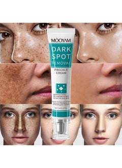 Dark Spot Removal Freckle Cream, Fast-Acting Dark Spot Corrector Remover For Face And Body Hyperpigmentation, Fades Melasma, Freckle, Sun Spots, Evens Skin Tone, Age Spot Remover - pzsku/Z6E7D6658F1B51F85A41AZ/45/_/1736235736/c1731426-6188-4dc0-bf47-4c4a56554747