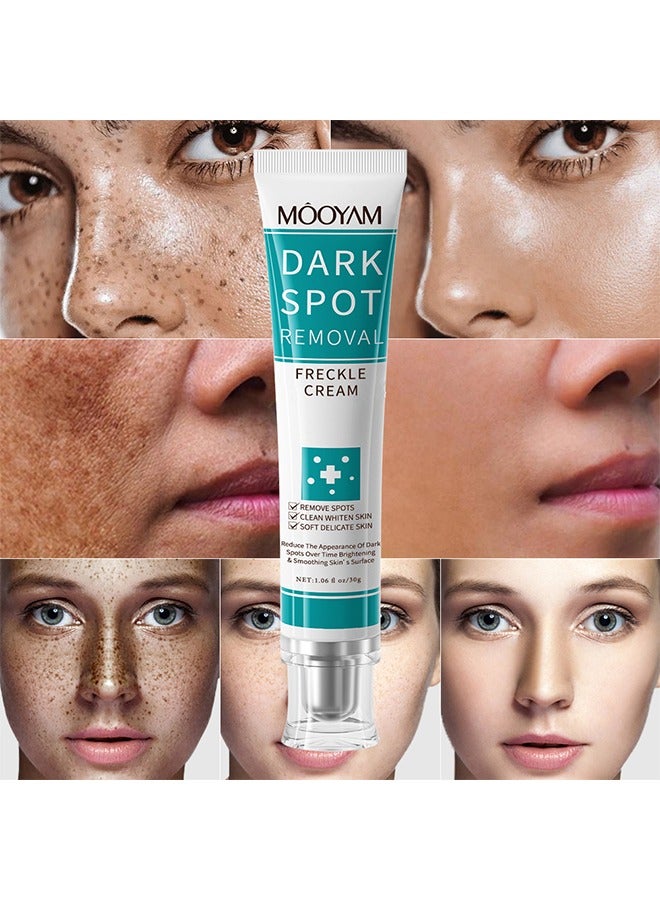 MOOYAM Dark Spot Removal Freckle Cream, Fast-Acting Dark Spot Corrector Remover For Face And Body Hyperpigmentation, Fades Melasma, Freckle, Sun Spots, Evens Skin Tone, Age Spot Remover  - Image 2