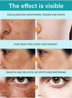 Dark Spot Removal Freckle Cream, Fast-Acting Dark Spot Corrector Remover For Face And Body Hyperpigmentation, Fades Melasma, Freckle, Sun Spots, Evens Skin Tone, Age Spot Remover - pzsku/Z6E7D6658F1B51F85A41AZ/45/_/1736235756/471e7ae9-0396-4538-b907-939bf7493e7f