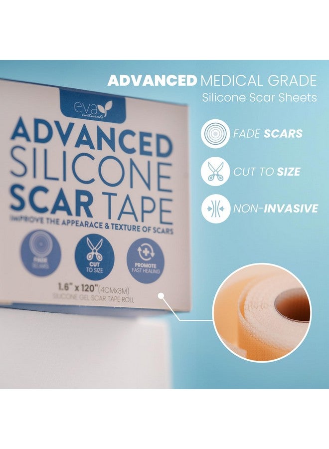 إيفا ناتشورالز شريط سيليكون طبي ناعم للندبات (1.6 بوصة × 120 بوصة) يقلل من ظهور تضخم القسم الجراحي على شكل حرف C ندبات الجدرة وندبات حب الشباب شريط ندبات السيليكون للندبات الجراحية ندبات السيليكون - Image 4