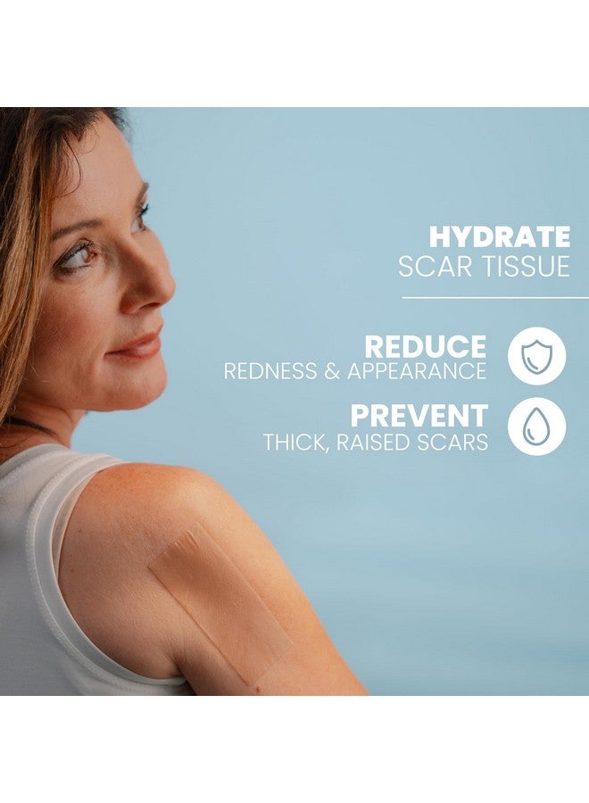 إيفا ناتشورالز شريط سيليكون طبي ناعم للندبات (1.6 بوصة × 120 بوصة) يقلل من ظهور تضخم القسم الجراحي على شكل حرف C ندبات الجدرة وندبات حب الشباب شريط ندبات السيليكون للندبات الجراحية ندبات السيليكون - Image 3