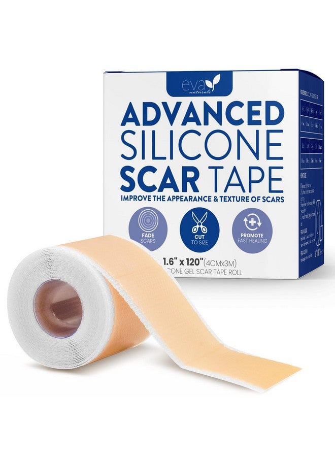 إيفا ناتشورالز شريط سيليكون طبي ناعم للندبات (1.6 بوصة × 120 بوصة) يقلل من ظهور تضخم القسم الجراحي على شكل حرف C ندبات الجدرة وندبات حب الشباب شريط ندبات السيليكون للندبات الجراحية ندبات السيليكون - Image 1