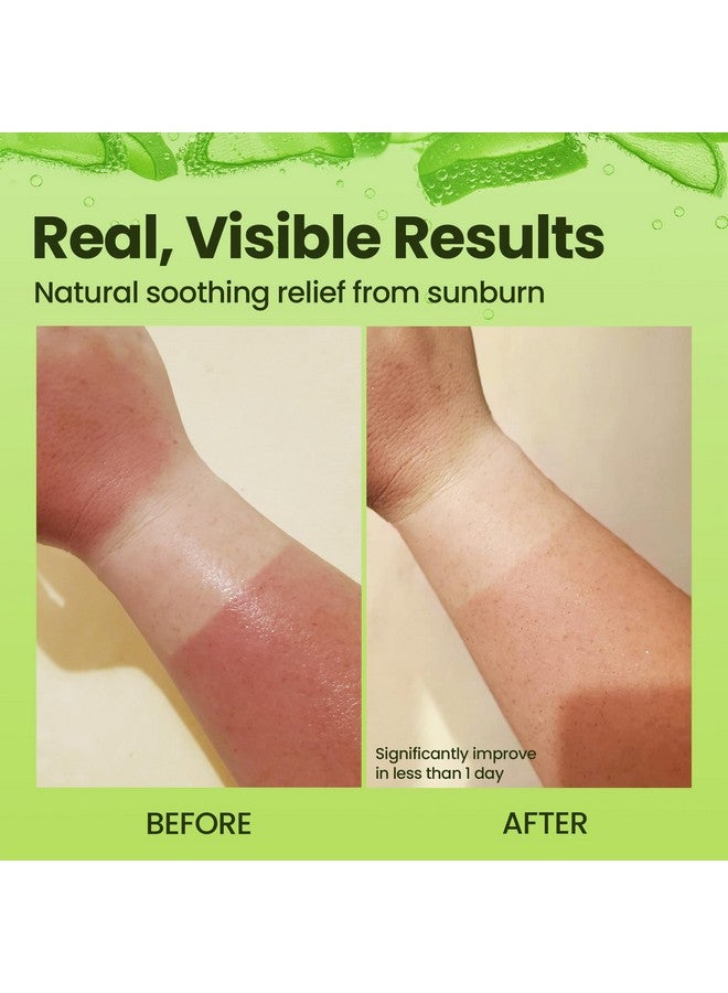 Honeyskin Soothing Aloe Vera Gel Made in the USA with Natural Ingredients - Give Yourself Relief From Sunburn and Dry Skin During the Hot Summer Days (8 Fl Oz) - Image 5