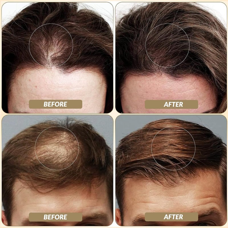 SOVONCARE Hair Fibers for Thinning Hair, Black Hair Building Fibers for Bald Spots Undetectable & Natural, Conceals Hair Loss, Fill In Fine Hair Powder Hair Thicker Instantly for Women & Men 28g - Image 3
