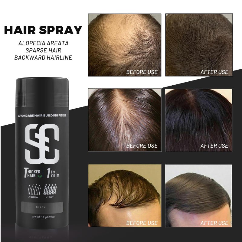 SOVONCARE Hair Fibers for Thinning Hair, Black Hair Building Fibers for Bald Spots Undetectable & Natural, Conceals Hair Loss, Fill In Fine Hair Powder Hair Thicker Instantly for Women & Men 28g - Image 2