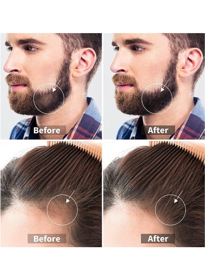 Loquat Hair Growth Roller,Microneedle Roller Skin Roller for Beard,540 Titanium Micro Needles Roller, 0.25mm Face Neck Hair Growth Body Wrinkle Acne Scar Stretch Mark Treatment,At-Home Beauty Instrument - Image 3