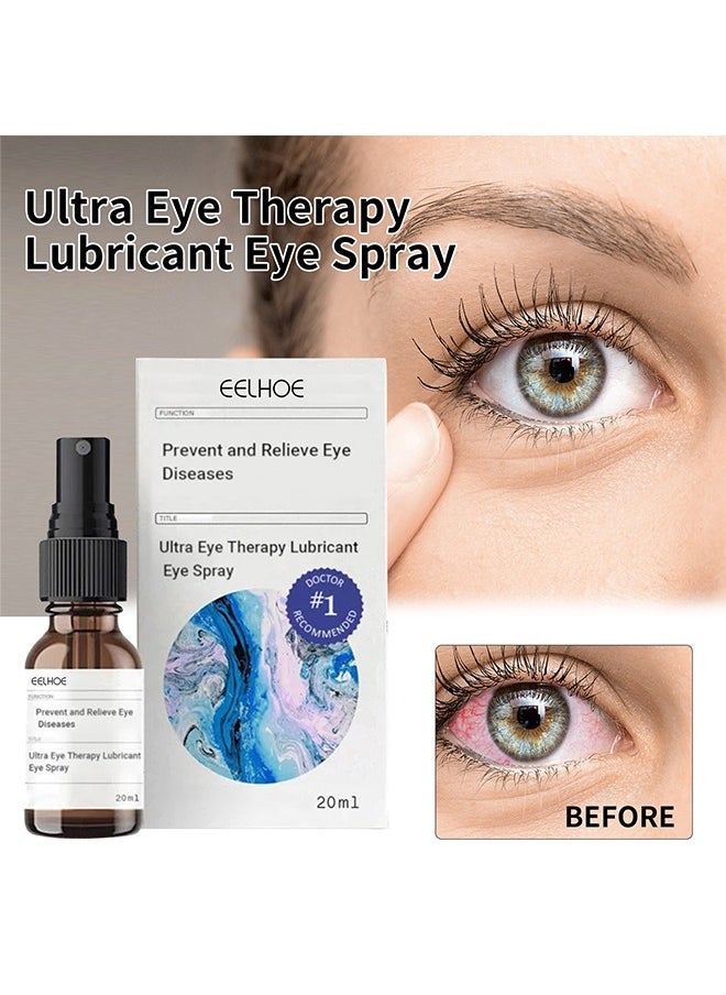 EELHOE - Lubricant Eye Spray 20ml Prevent and Relieve Eye Diseases, Eye Care Lubricating Spray Relieve Eye Fatigue Dry Eyes Eye Care Spray Provide Soothing Relief for Tired, Dry, and Irritated Eyes - Image 1
