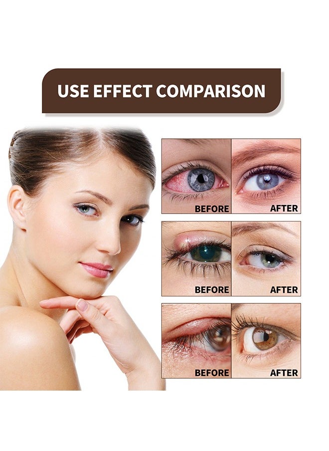 EELHOE - Lubricant Eye Spray 20ml Prevent and Relieve Eye Diseases, Eye Care Lubricating Spray Relieve Eye Fatigue Dry Eyes Eye Care Spray Provide Soothing Relief for Tired, Dry, and Irritated Eyes - Image 1