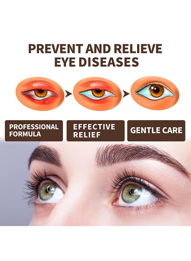 EELHOE - Lubricant Eye Spray 20ml Prevent and Relieve Eye Diseases, Eye Care Lubricating Spray Relieve Eye Fatigue Dry Eyes Eye Care Spray Provide Soothing Relief for Tired, Dry, and Irritated Eyes - Image 1