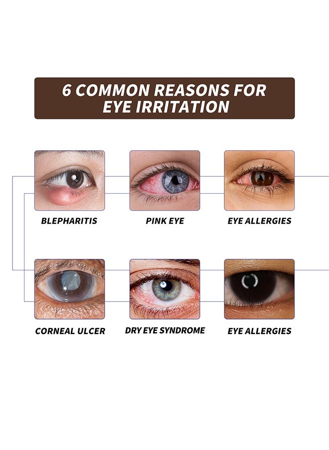 EELHOE - Lubricant Eye Spray 20ml Prevent and Relieve Eye Diseases, Eye Care Lubricating Spray Relieve Eye Fatigue Dry Eyes Eye Care Spray Provide Soothing Relief for Tired, Dry, and Irritated Eyes - Image 1