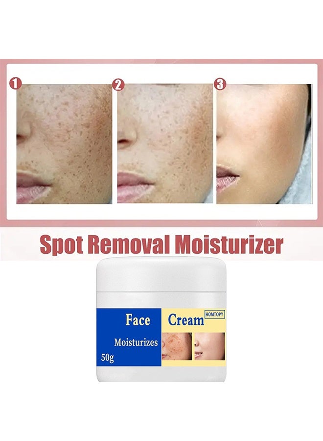HOMTOPY Face Moisturizes Cream, Dark Spot Remover for Face, Melasma Treatment, Hyperpigmentation Corrector, Spot Cream with Vitamin C and Glycerol, Fades Sun Spots and Freckles for Even Skin Tone 50g - Image 4