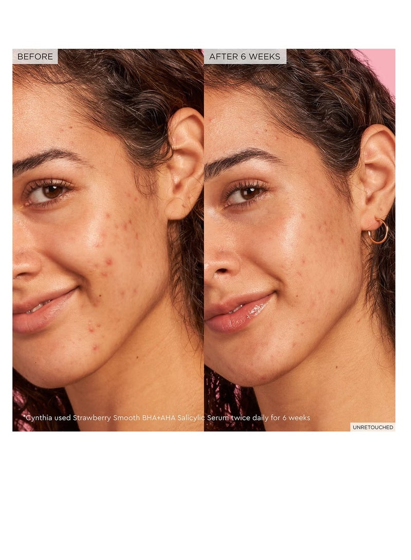 GLOW RECIPE سيروم حمض الساليسيليك GLOW RECIPE بالفراولة، 30 مل - Image 2