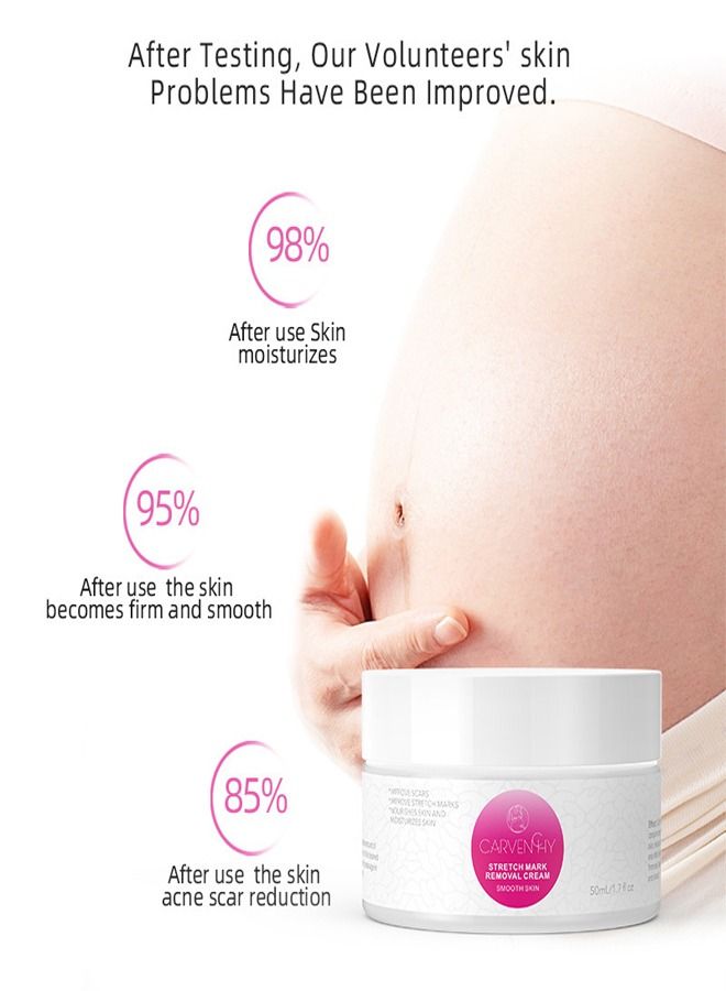CARVENCHY Fat Marks,Stretch Marks Firming Repair Cream 50ML - Image 5