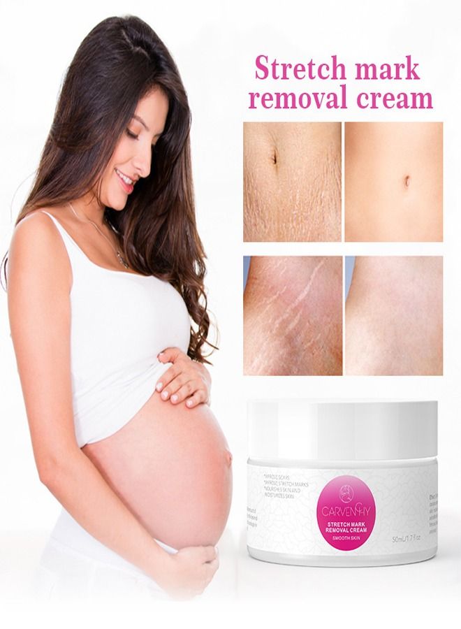 CARVENCHY Fat Marks,Stretch Marks Firming Repair Cream 50ML - Image 3