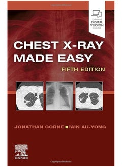 Chest X-Ray Made Easy 