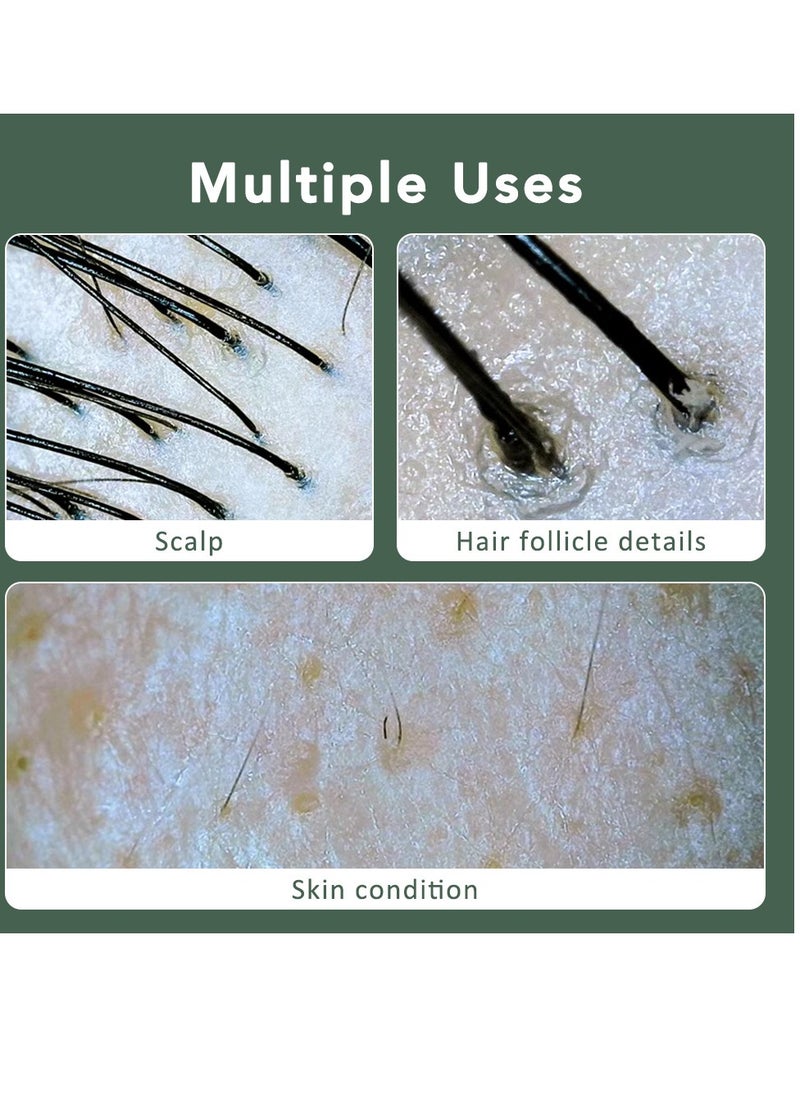 General - High definition visual scalp detector Multifunctional portable hair follicle skin tester Blackhead pore detector - Image 1