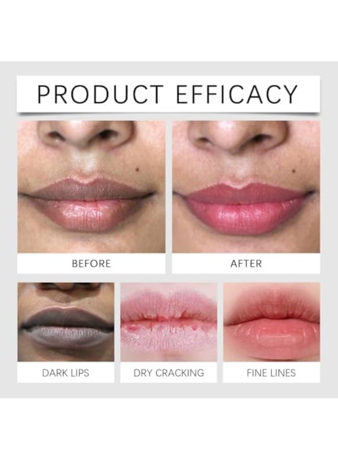 OUHOE Lip Lightening Balm for Dark Lips, Lip Hyperpigmentation Treatment, Brightening Lip Balm for Smokers and Non-Smokers, Repair Reduce Lips Lines, Softening Lip Care, Moisturizing and Nourishing (3) - Image 2