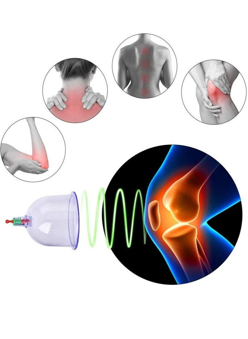 12 Piece Islamic Cupping Cups Set with Suction Device Reliable alternative therapy for health and wellness - Image 2