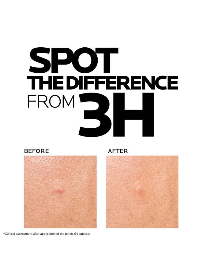 لصقات إيفاكلار ديو+م - لصقات حب الشباب الواضحة بتقنية الهيدروكولود، تقلل من حب الشباب في غضون 8 ساعات، للبشرة المعرضة لحب الشباب