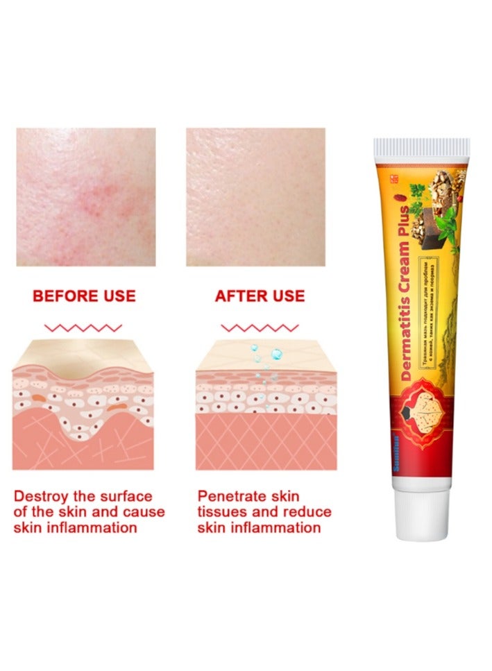 Sumifun Natural Chinese Herbal Cream,Anti Chafing Cream,Antifungal Body Cream,Anti Itch Cream,Dermatitis Cream Puls 20g - Image 3