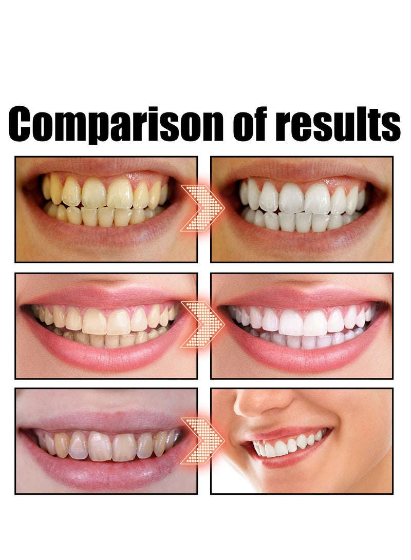 إيلهو زيت جوز الهند والنعناع لتعزيز صحة الفم، غسول للفم لعلاج رائحة الفم الكريهة للبالغين، سحب الزيت بجوز الهند للأسنان واللثة، غسول فم للمساعدة في إنعاش النفس، تبييض الأسنان، العناية الطبيعية بالفم - Image 5