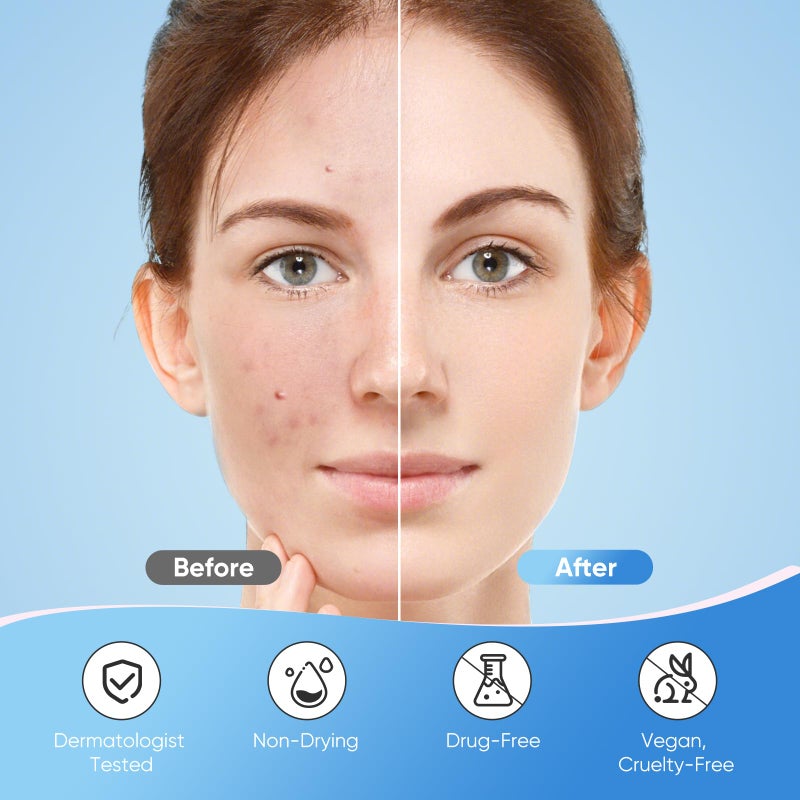QUSTERE Pimple Patches for Face, Hydrocolloid Acne Patches, Sparkling Star Zit Covers, Colorful Spot Stickers with Tea Tree, Salicylic Acid & Cica Oil| 3 Sizes (10mm, 12mm & 14mm) |240 Count - Image 5