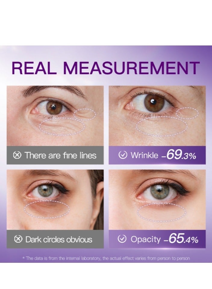 BIOAOUA 4 Pairs Freeze Dried Eye Mask - Image 5