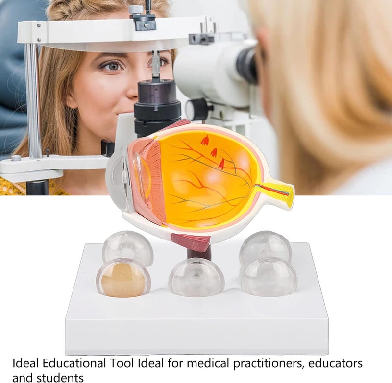 klarako Eye Anatomy Model,klarako Enlarged Human Eye Anatomical Model Accurate Shows Optic Nerves Cornea Iris Lens Cataracts Eyeball Model - Image 4