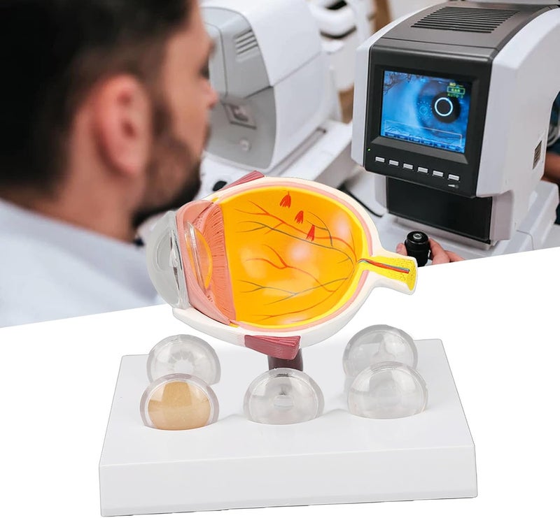 klarako Eye Anatomy Model,klarako Enlarged Human Eye Anatomical Model Accurate Shows Optic Nerves Cornea Iris Lens Cataracts Eyeball Model - Image 5