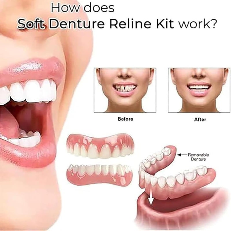 Denture Adhesive Cushion Soft Silicone Blue Denture Liner - Natural Looking Secure Fit for All-Day Dental Comfort - Image 2