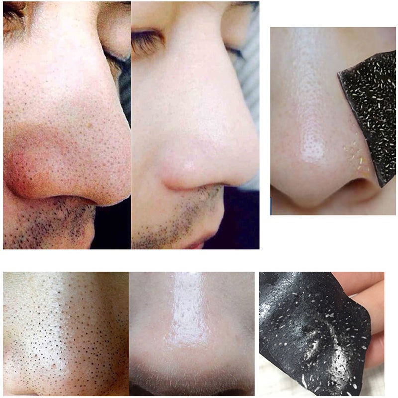 Deep Cleansing Pore Strips 10 Nose Strips for Men & Women Blackhead Removal - Image 4