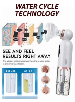 DBLEW Blackhead Remover with Water Cycle Technology Small Bubble Facial Pore Cleaner Whitehead Extractor 6 In 1 Probes Beauty Vacuum Device USB Rechargeable for Acne Pimple Comedone for Women & Men  - Image 2