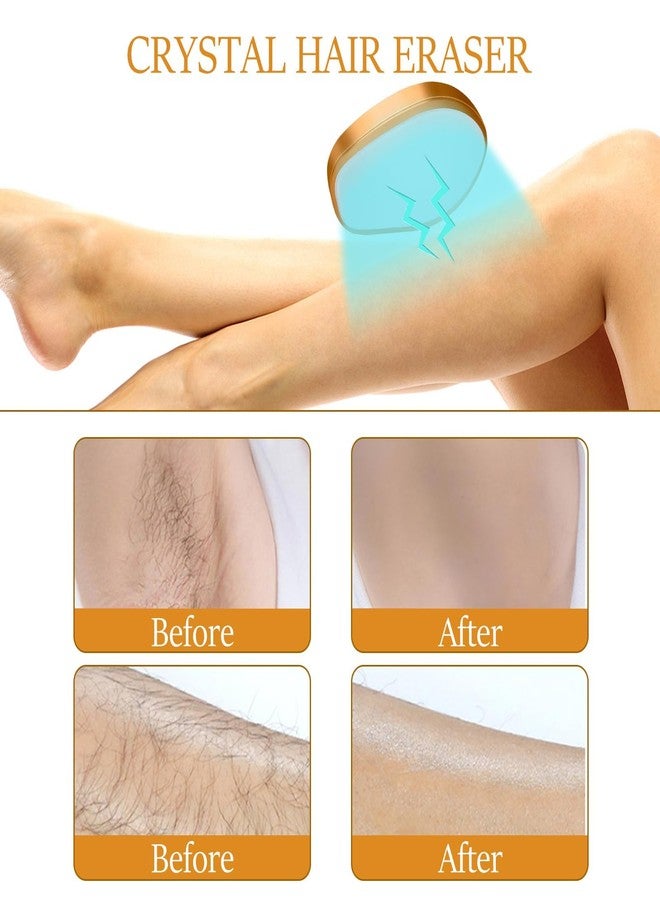FITALA Crystal Hair Eraser, Painless Hair Removal Tool, Reusable Hair Remover for All Body Parts (Gold - Image 5