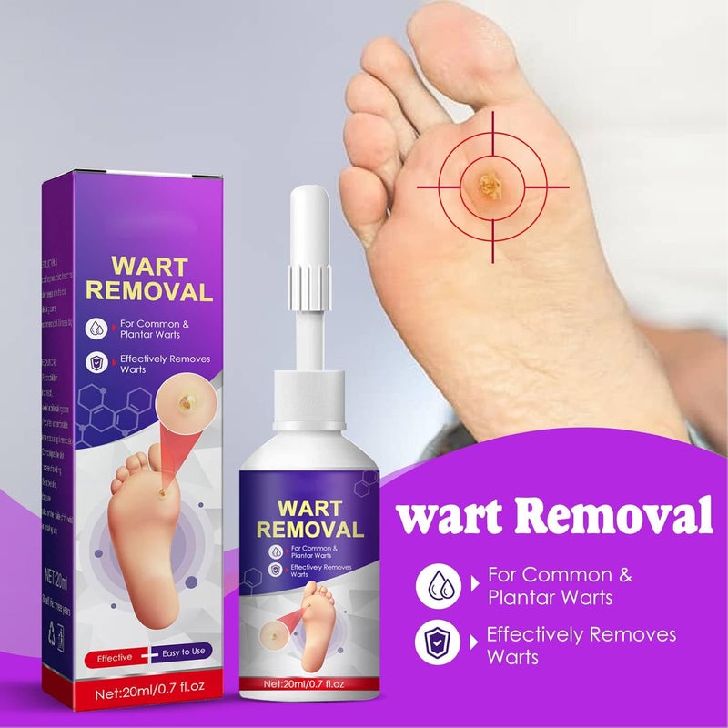 comfrt 20ML Wart Removal Liquid, Safe Efficient Plantar Wart Remover, for Face Limbs Reproductive Organs and Soles, Painlessly Removes Plantar - Image 1