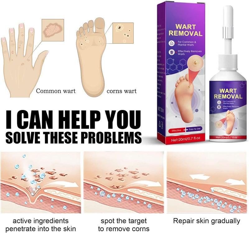 comfrt 20ML Wart Removal Liquid, Safe Efficient Plantar Wart Remover, for Face Limbs Reproductive Organs and Soles, Painlessly Removes Plantar - Image 2