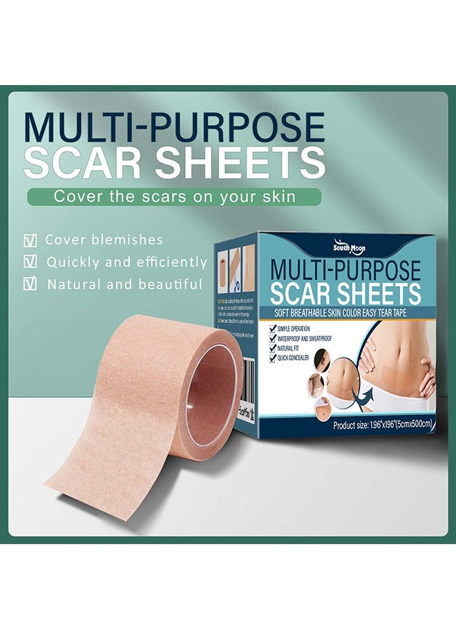 SOUTH MOON Complexion Concealer Patches - Skin Scar Tattoos Acne Scar Patches - Waterproof Complexion Patches  - Image 3