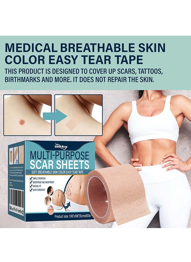 SOUTH MOON - Complexion Concealer Patches - Skin Scar Tattoos Acne Scar Patches - Waterproof Complexion Patches - Image 1
